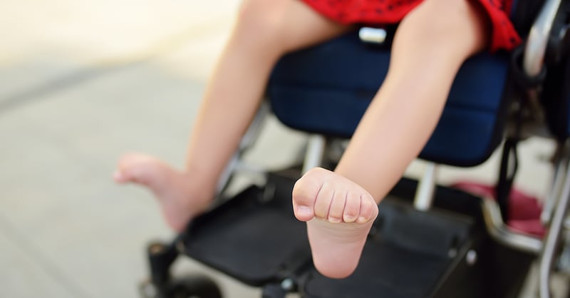 Handikappad flicka i sin rullstol. Närbild på hennes ben och spastiska muskler.