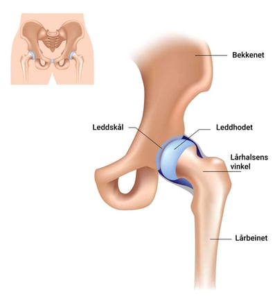 NO_Hip joint