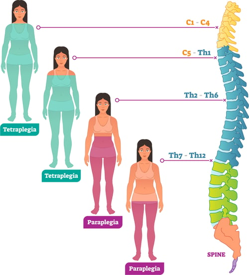 What is spinal cord injury?